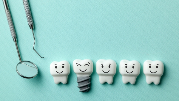 Quali e quanti tipi di impianto dentale esistono?